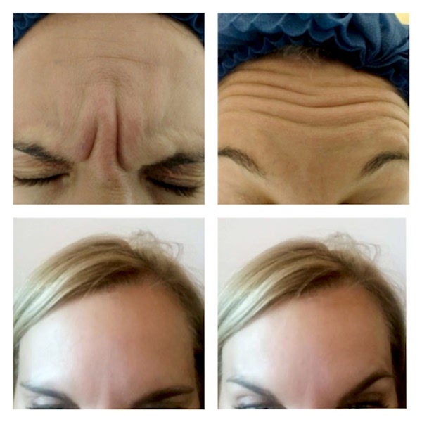 Диспорт в Алматы