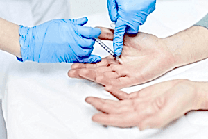 Лечение Гипергидроза на руках в Алматы