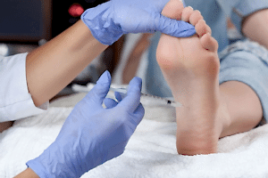 Лечение Гипергидроза Стоп